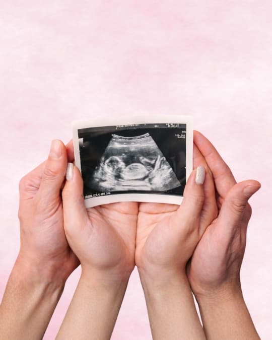 A couple holding an ultrasound picture